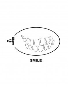 STE-13 SMILE